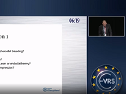 How to (Not) Perform a Retinectomy