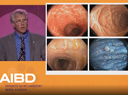 How to use chromoendoscopy and high definition white light endoscopy