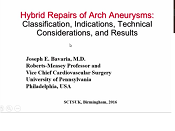 Hybrid Repairs of Arch Aneurysms