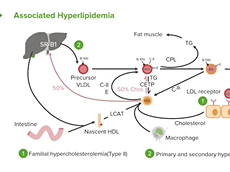 Hyperlipidemia: Type 2 & Type 4 Hyperlipidemia: Type 2 & Type 4