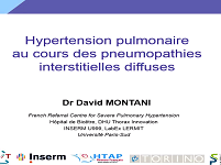 Hypertension pulmonaire au cours des pneumopathies interstitielles diffuses
