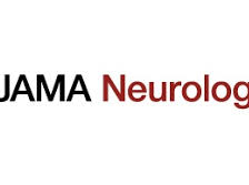 Hypertrophic Olivary Degeneration Part 1 Hypertrophic Olivary Degeneration Part 1