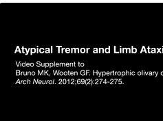Hypertrophic Olivary Degeneration Part 2 Hypertrophic Olivary Degeneration Part 2