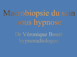 Hypnoanalgésie et macrobiopsie du sein : extraits du DVD