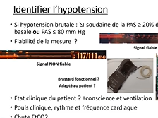 Hypotension artérielle en réanimation
