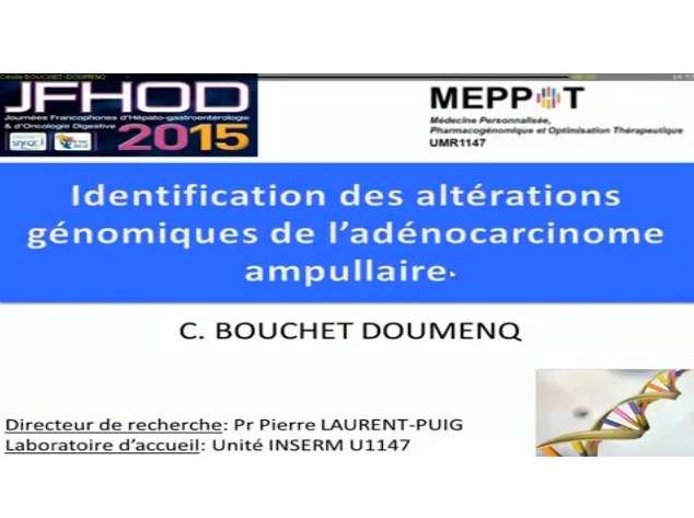 Identification des altérations génétiques de l’adénocarcinome ampullaire : analyse des différences entre le type intestinal et le type bilio-pancréatique : une étude de l’AGEO