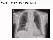 Identifying Autoimmune Interstitial Lung Diseases: A Rheumatologists Perspective Identifying Autoimmune Interstitial Lung Diseases: A Rheumatologists Perspective