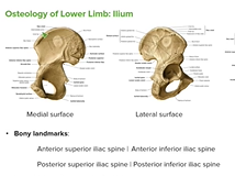 Ilium: Body & Bony Landmarks - Anatomy Ilium: Body & Bony Landmarks - Anatomy