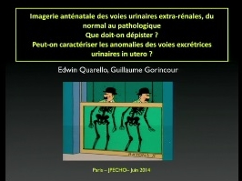 Imagerie anténatale des voies urinaires extra-renales, du normal au pathologique - Que doit-on dépister? Peut-on caractériser les anomalies des voies excrétrices urinaires in utero? Imagerie anténatale des voies urinaires extra-renales, du normal au pathologique - Que doit-on dépister? Peut-on caractériser les anomalies des voies excrétrices urinaires in utero?