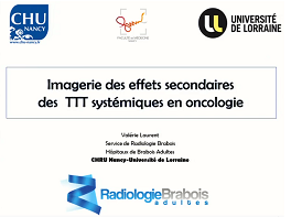 Imagerie des effets secondaires des chimiothérapies