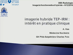 Imagerie hybride TEP-IRM : intérêt en pratique clinique Imagerie hybride TEP-IRM : intérêt en pratique clinique