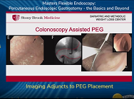 Imaging Adjuncts to PEG Placement