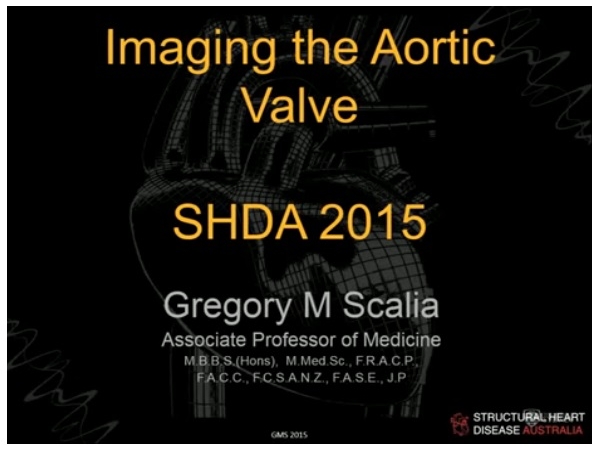 Imaging the aortic valve