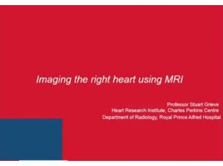 Imaging the right heart using MRI