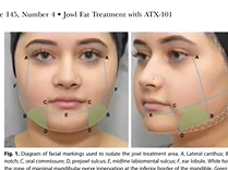 Improving Breast Recon. Access in 6 Steps: #PlasticSurgery Hot Topics with Rod J. Rohrich, MD Improving Breast Recon. Access in 6 Steps: #PlasticSurgery Hot Topics with Rod J. Rohrich, MD