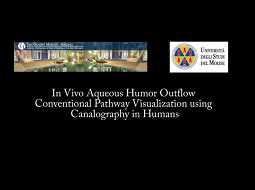 In Vivo Aqueous Humor Outflow Conventional Pathway Visualization Using Canalography in Humans In Vivo Aqueous Humor Outflow Conventional Pathway Visualization Using Canalography in Humans