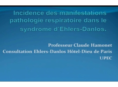 Incidence des manifestations pathologie respiratoire dans le syndrome d'Ehlers Danlos Incidence des manifestations pathologie respiratoire dans le syndrome d'Ehlers Danlos