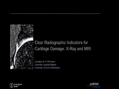Indicateurs radiographiques clairs des dommages cartilagineux : RX et IRM