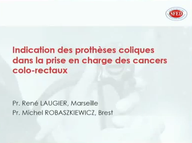 Indication des prothèses coliques dans la prise en charge des cancers colo-rectaux Indication des prothèses coliques dans la prise en charge des cancers colo-rectaux