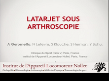 Indications arthroscopiques dans les épaules instables Indications arthroscopiques dans les épaules instables