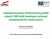 Indocyanine green fluorescence-guided robotic TME with coloanal anastomosis for rectal cancer Indocyanine green fluorescence-guided robotic TME with coloanal anastomosis for rectal cancer