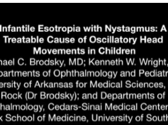 Infantile Esotropia With Nystagmus: A Treatable Cause of Oscillatory Head Movements in Children Infantile Esotropia With Nystagmus: A Treatable Cause of Oscillatory Head Movements in Children