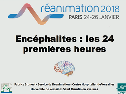 Infection du système nerveux central