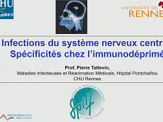 Infection du système nerveux central