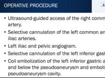 Inferior Epigastric Artery Pseudoaneurysm Coil Embolization Inferior Epigastric Artery Pseudoaneurysm Coil Embolization