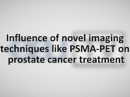 Influence of novel imaging techniques like PSMA PET on prostate cancer treatment Influence of novel imaging techniques like PSMA PET on prostate cancer treatment