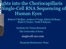 Insights into the Choriocapillaris from Single-Cell RNA