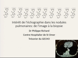 Intérêt de l'échographie dans les nodules pulmonaires : de l'image à la biopsie Intérêt de l'échographie dans les nodules pulmonaires : de l'image à la biopsie