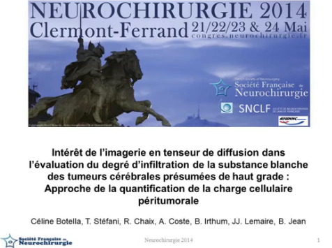 Intérêt de l’imagerie en tenseur de diffusion et séquence de perfusion dans l’évaluation du degré d’infiltration tumorale de la substance blanche des tumeurs cérébrales de haut grade