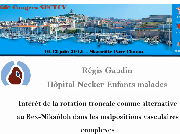 Intérét de la rotation conotroncale comme alternative au Bex Nikaidoh