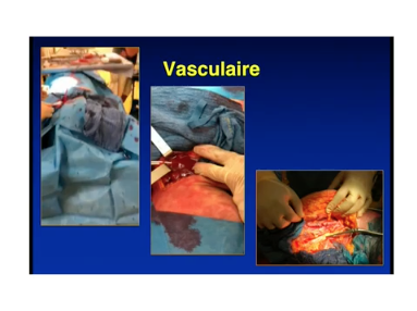 Intérêt de la technologie SimLife dans lenseignement de la chirurgie Intérêt de la technologie SimLife dans lenseignement de la chirurgie