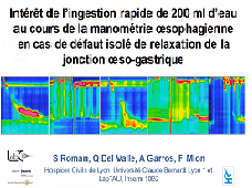 Intérêt de l'ingestion rapide de 200 ml d'eau au cours de la manométrie oesophagienne en cas de défaut isolé de relaxation de la jonction oeso-gastrique
