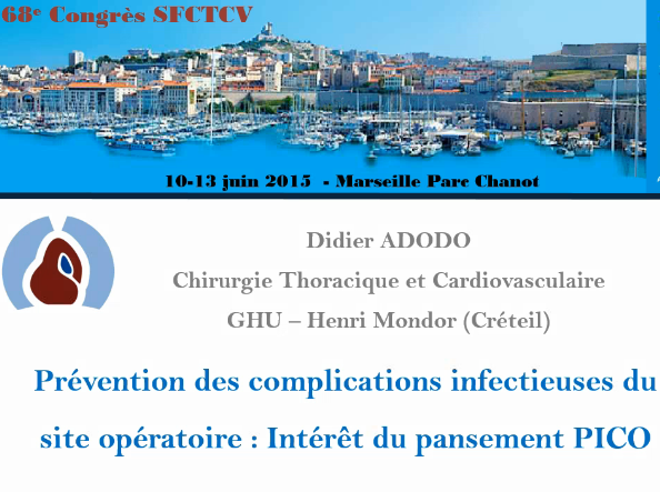 Intérét du pansement PICO en chirurgie cardiovasculaire