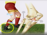 Interaction Influences Injury Risk in Football Interaction Influences Injury Risk in Football