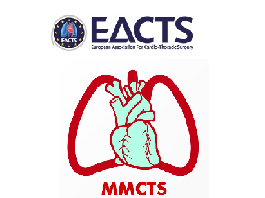 Internal mammary artery