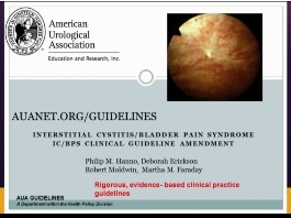 Amendement des directives pour la cystite interstitielle