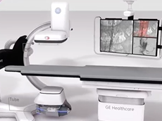 Interventional X-ray. A highly effecient detector even at low