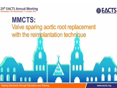 Interviews MMCTS - Remplacement de la crosse aortique en épargnant la valve avec la technique de réimplantation Interviews MMCTS - Remplacement de la crosse aortique en épargnant la valve avec la technique de réimplantation
