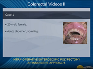 INTRA-OPERATIVE ENTEROSCOPIC POLYPECTOMY- AN INNOVATIVE APPROACH