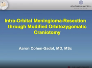 Intra-Orbital Meningioma-Resection through Modified Orbitozygomatic Craniotomy Intra-Orbital Meningioma-Resection through Modified Orbitozygomatic Craniotomy
