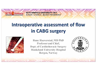 Intraoperative assessment of flow in CABG surgery Intraoperative assessment of flow in CABG surgery
