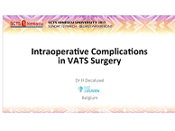 Intraoperative complications in VATS surgery Intraoperative complications in VATS surgery