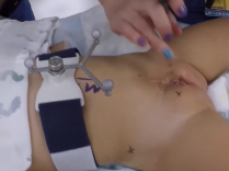 Intraoperative MRI-Guided Navigation of the Pelvic Floor During Exstrophy Closure Intraoperative MRI-Guided Navigation of the Pelvic Floor During Exstrophy Closure