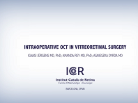 Intraoperative OCT for Vitreoretinal Surgery Intraoperative OCT for Vitreoretinal Surgery