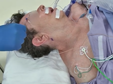 Intro to Ear Surgery: Two Lead Facial Nerve Monitor and Prep