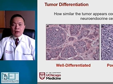 Intro to Neuroendocrine Tumors - Chih-Yi Andy Liao